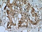 USP15 Antibody in Immunohistochemistry (Paraffin) (IHC (P))