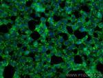 PAK6 Antibody in Immunocytochemistry (ICC/IF)
