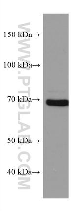 PAK6 Antibody in Western Blot (WB)