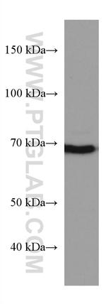 PAK6 Antibody in Western Blot (WB)