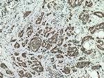 GRP75 Antibody in Immunohistochemistry (Paraffin) (IHC (P))