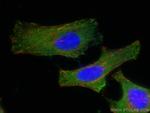 PICALM Antibody in Immunocytochemistry (ICC/IF)