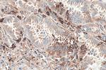 PICALM Antibody in Immunohistochemistry (Paraffin) (IHC (P))
