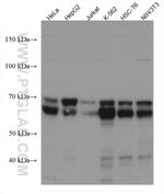 PICALM Antibody in Western Blot (WB)