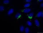RPS14 Antibody in Immunocytochemistry (ICC/IF)