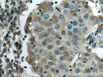 STAT4 Antibody in Immunohistochemistry (Paraffin) (IHC (P))