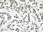 TAF6L Antibody in Immunohistochemistry (Paraffin) (IHC (P))