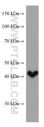 HSD3B2 Antibody in Western Blot (WB)