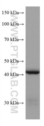 HSD3B2 Antibody in Western Blot (WB)
