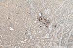 ETV6 Antibody in Immunohistochemistry (Paraffin) (IHC (P))