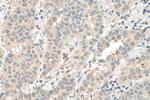 ETV6 Antibody in Immunohistochemistry (Paraffin) (IHC (P))