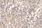 ETV6 Antibody in Immunohistochemistry (Paraffin) (IHC (P))