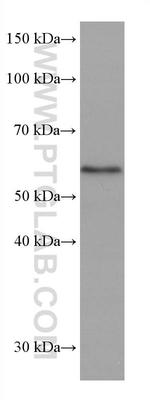 ETV6 Antibody in Western Blot (WB)