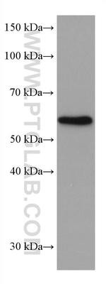 ETV6 Antibody in Western Blot (WB)