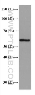 ETV6 Antibody in Western Blot (WB)
