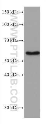 ETV6 Antibody in Western Blot (WB)