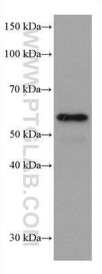 ETV6 Antibody in Western Blot (WB)