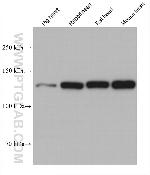 UBAP2L Antibody in Western Blot (WB)
