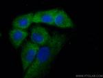 VPS18 Antibody in Immunocytochemistry (ICC/IF)