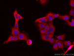 NCF2 Antibody in Immunocytochemistry (ICC/IF)
