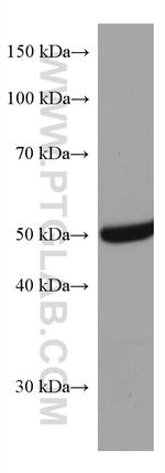 GSS Antibody in Western Blot (WB)