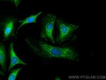 Prx5 Antibody in Immunocytochemistry (ICC/IF)