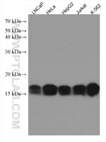 Prx5 Antibody in Western Blot (WB)
