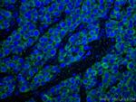 SDHB Antibody in Immunohistochemistry (Paraffin) (IHC (P))