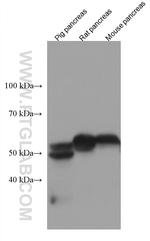 PNLIPRP1 Antibody in Western Blot (WB)