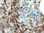 Collagen Type V Antibody in Immunohistochemistry (Paraffin) (IHC (P))