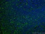 CD63 Antibody in Immunohistochemistry (Paraffin) (IHC (P))