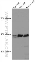 MYBPC3 Antibody in Western Blot (WB)