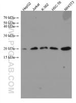 RPS10 Antibody in Western Blot (WB)