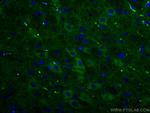 NCS1 Antibody in Immunohistochemistry (PFA fixed) (IHC (PFA))