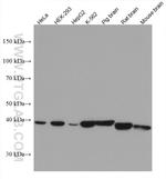 PSAT1 Antibody in Western Blot (WB)
