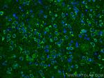 WASF3 Antibody in Immunohistochemistry (PFA fixed) (IHC (PFA))