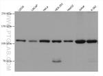 DIS3L2 Antibody in Western Blot (WB)