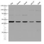 VSX2 Antibody in Western Blot (WB)
