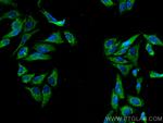 Ch-TOG Antibody in Immunocytochemistry (ICC/IF)