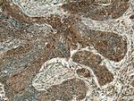 Maspin Antibody in Immunohistochemistry (Paraffin) (IHC (P))