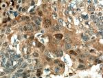 Maspin Antibody in Immunohistochemistry (Paraffin) (IHC (P))