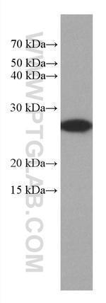 GSTM3 Antibody in Western Blot (WB)