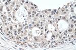 EXOSC9 Antibody in Immunohistochemistry (Paraffin) (IHC (P))