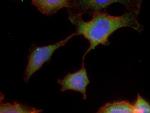 CCDC6 Antibody in Immunocytochemistry (ICC/IF)