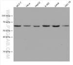 CCDC6 Antibody in Western Blot (WB)