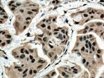 BAT1 Antibody in Immunohistochemistry (Paraffin) (IHC (P))