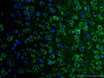 GRIA1 Antibody in Immunohistochemistry (Paraffin) (IHC (P))