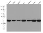 MAT2B Antibody in Western Blot (WB)