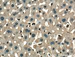 GSTT1 Antibody in Immunohistochemistry (Paraffin) (IHC (P))