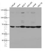 HDAC10 Antibody in Western Blot (WB)